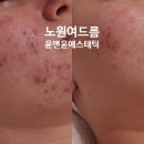 노원역 5번출구 이미지