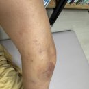 선율당한의원 네이버블로그
