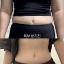 편한자리의원 | 상상했던 라인이 현실로, 신사 복부 지방분해주사 의원 4회차 리얼 후기