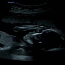 패트라산부인과의원 이미지