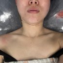 WR(부산광역시 강서구)-[명지국제1로]-하-2 | 강서구 명지 등관리, 바디관리 잘하는 화문에스테틱에서 하체관리 받은 후기