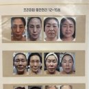 박성희한의원 | [수영 예뻐졌다] 갈바닉 미세전류 뉴스킨 복부관리 받고 온 후기
