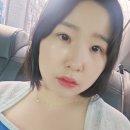 아이뷰안경 | 매몰법 쌍수 후기 1일차~40일차 (아이뷰성형외과)