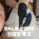 에스에이(SA)왁싱 스킨케어 | 파주 운정피부관리 SA왁싱&amp;스킨케어 윤곽관리 브이핏 브이라인 후기