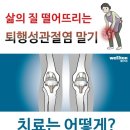 무릎인공관절수술 & 무릎 인공관절치환술 & 인공관절수술 & 인공관절수술잘하는 곳 /웰튼병원 /무릎인공관절수술 이미지