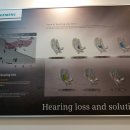 시그니아 독일보청기 인천부평센터 이미지