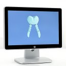 봄치과의원 | 갑자기 치아 걱정 모드 발동! 연세봄치과의원 첫 방문 썰 푼다