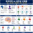 《뇌 건강 상식 》트라우마 vs 심인성 신체증 이미지