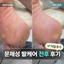 홍제동물병원 | 멸균 시스템을 갖춘 레푸스 연신내점 무좀 발톱이나 문제성 손발톱 깔끔하게 관리받고 온 리얼후기