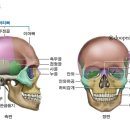 안와골절 이미지