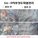 에스엠알두피탈모전문