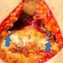 리터닝성형외과의원 이미지