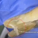 엔도위즈 이미지