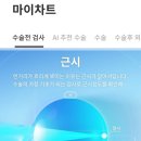 서울이안과의원 | [라섹 수술 후기 0편] 어디서 어떤 수술을 할까? 병원 찾기, 시력교정 검사