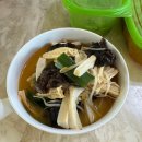 남4통 | 게실염 치료 후기 - 대장도 내맘대로 안되는 것이였구나,,