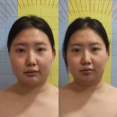 대진카센타 | 사하구 피부관리 하단 아르떼뷰티에서 두골비 윤곽관리 받아본 솔직후기