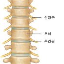 [BGM][의학/질병]척추의 퇴행은 10대후반부터 나타난다! 추간판 탈출증(허리디스크) 이미지
