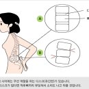 라임나무한의원 네이버블로그