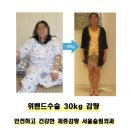 비만 중에서도 위험한 병적비만, 당뇨와 고혈압 그리고 각종 암은 인간의 수명단축을 유도 이미지