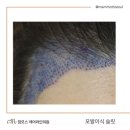 디자인슬릿 이미지
