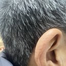 시그니아독일보청기 동작센터 이미지