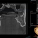 연세내일치과의원 이미지