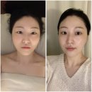 씨엘 | 상도동피부관리 예비신부의 씨엘스파 방문 후기