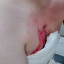 파랑새의원 | 마리앙의 천호 제너리스 의원 에스테필) 천호 피부과 제너리스 의원 에스테필 이야기