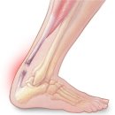 청담리온정형외과의원 이미지