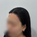 투쓰리 헤어라인 | 성수 투윅스 2WEEKS 헤어라인 전문 두피문신 시술 후기