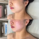 [파주 야당역 피부관리] SA왁싱&amp;스킨케어 파주야당역점 (신부관리 후기)