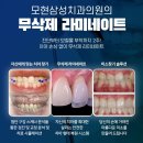 지센익산 - 익산시 고봉로32길 23 | 익산역치과 무삭제라미네이트 후기가 좋은 이유는?