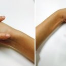 건강 셀프마사지 이미지