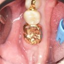 플래닝 치과기공소 이미지