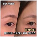 씨유천안두정타운점 | 천안 눈썹 붉은 잔흔 관리 후기｜미작뷰티 2회차 변화 기록
