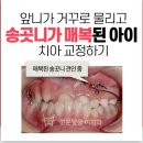 고운얼굴치과의원 | 청주 교정 잘하는 치과, 더 엄밀하게 따져본다면