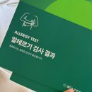 두리약국 | MAST 알레르기 검사 | 야탑 두리이비인후과 대기시간