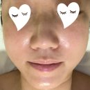 별양로 | 과천피부관리 맛집 &#39;과천세레니끄&#39;, 윤곽라인 모공케어 솔직후기