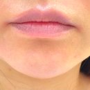 디아트의원 이미지