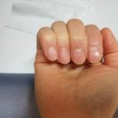 인네일(Innail)