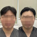 대구달서우체국 | [대구 달서구 감삼동 죽전역 피부샵] 피부탄력관리는 피오라뷰티샵!(with 써마젯)