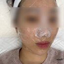 주(연) | 천안 연뷰티 불당동 세라링 후기 스킨플래닝 비교