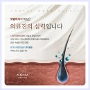 비절개모발이식 나에게 맞는 디자인과 수술방법 상담 후기