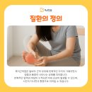 방그레병원 | 미추홀구재활병원, 족저근막염 회복 과정에서 중요한 재활 관리