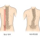 이렇게 한쪽만 불편한데 이유가 뭘까 이미지