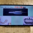 군산 80대 어르신 디지털 스캐너로 편하게 임플란트 보철 했어요 — 함께하는치과의원
