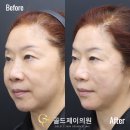 골드제이의원 이미지