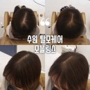 권선동 968-1 | [수원탈모케어, 모블링스] 탈모로 걱정이라면 티 안 나게 커버 가능한 헤어증모 추천!