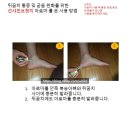 썬샤인브릿지 이미지