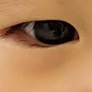 서초준안과의원 이미지